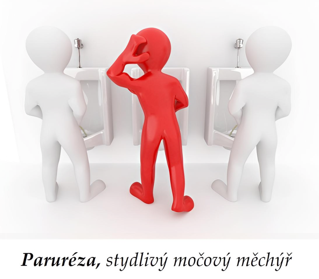 Strach z moen ped lidmi - Parurza